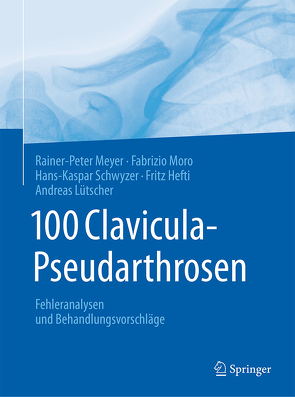 100 Clavicula-Pseudarthrosen von Hefti,  Fritz, Lütscher,  Andreas, Meyer,  Rainer-Peter, Moro,  Fabrizio, Schwyzer,  Hans-Kaspar