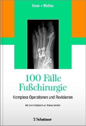 100 Fälle Fußchirurgie von Frank,  Mattes, Hase,  Charlotte