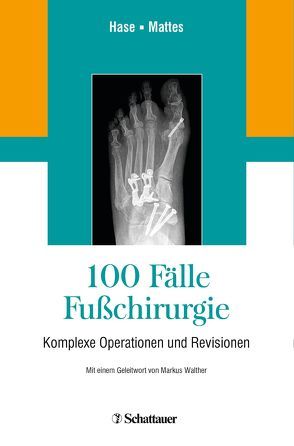 100 Fälle Fußchirurgie von Frank,  Mattes, Hase,  Charlotte