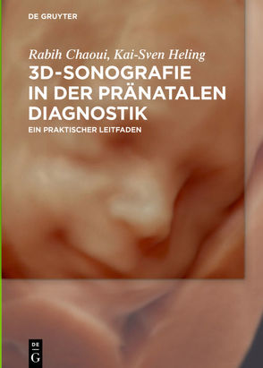 3D-Sonografie in der pränatalen Diagnostik von Chaoui,  Rabih, Heling,  Kai-Sven
