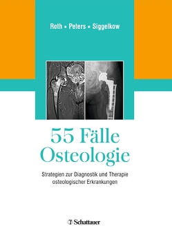 55 Fälle Osteologie von Peters,  Klaus M., Roth,  Andreas, Siggelkow,  Heide