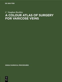 A Colour Atlas of Surgery for Varicose Veins von Ruckley,  C. Vaughan
