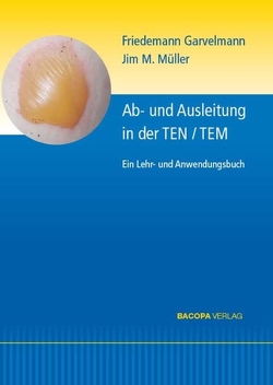 Ab- und Ausleitungsverfahren in der TEN/TEM. von Garvelmann,  Friedemann, Müller,  Jim M.