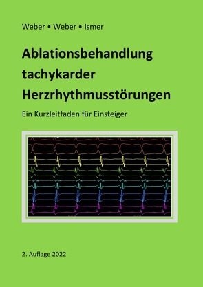 Ablationsbehandlung tachykarder Herzrhythmusstörungen von Weber,  Frank