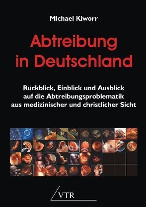 Abtreibung in Deutschland von Kiworr,  Michael