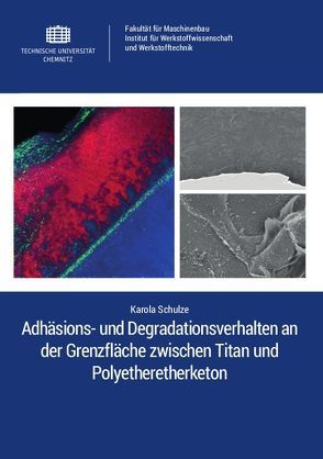 Adhäsions- und Degradationsverhalten an der Grenzfläche zwischen Titan und Polyetheretherketon von Schulze,  Karola