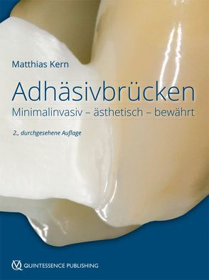 Adhäsivbrücken von Kern,  Matthias