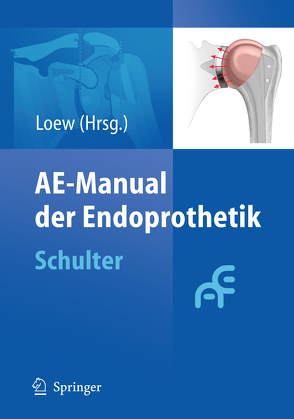 AE-Manual der Endoprothetik von Loew,  Markus