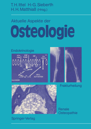 Aktuelle Aspekte der Osteologie von Ittel,  Thomas H., Matthiaß,  Hans H., Sieberth,  Heinz-Günther