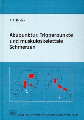 Akupunktur, Triggerpunkte und muskoskelettale Schmerzen von Baldry,  Peter E, Schreiner,  Wolfgang, Thompson,  John W