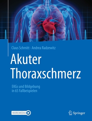 Akuter Thoraxschmerz von Radzewitz,  Andrea, Schmitt,  Claus