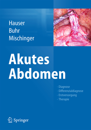 Akutes Abdomen von Buhr,  Heinz J., Hauser,  Hubert, Mischinger,  Hans-Jörg