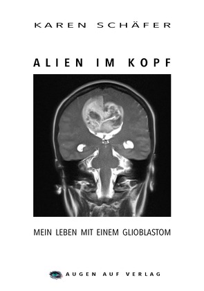 Alien im Kopf von Mischlich,  Klaus, Schäfer,  Karen