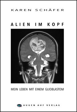 Alien im Kopf von Schäfer,  Karen