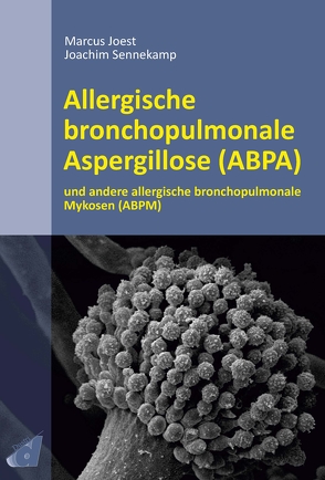 Allergische bronchopulmonale Aspergillose (ABPA) von Joest,  Marcus, Sennekamp,  Joachim