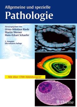 Allgemeine und spezielle Pathologie von Bianchi,  Leonardo, Böcking,  Alfred, Böhm,  Norbert, Riede,  Urs-Nikolaus, Schaefer,  Hans-Eckart