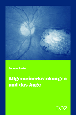 Allgemeinerkrankungen und das Auge von Berke,  Andreas