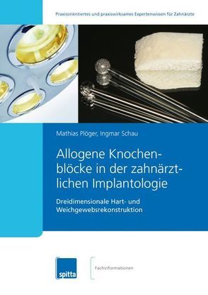 Allogene Knochenblöcke in der zahnärztlichen Implantologie von Plöger,  Mathias, Schau,  Ingmar