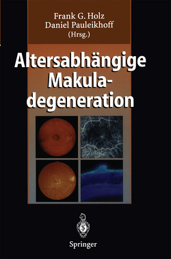 Altersabhängige Makuladegeneration von Holz,  Frank G., Pauleikhoff,  Daniel