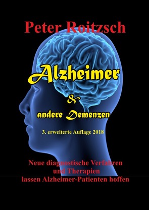 Alzheimer & andere Demenzen von Roitzsch,  Peter