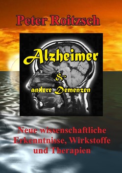 Alzheimer & andere Demenzen von Roitzsch,  Peter