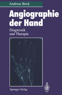 Angiographie der Hand von Beck,  Andreas