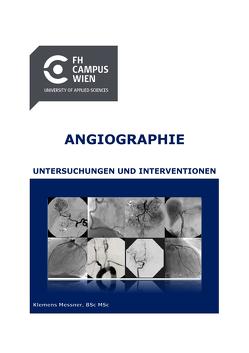 Angiographie – Untersuchungen und Interventionen von Messner,  Klemens
