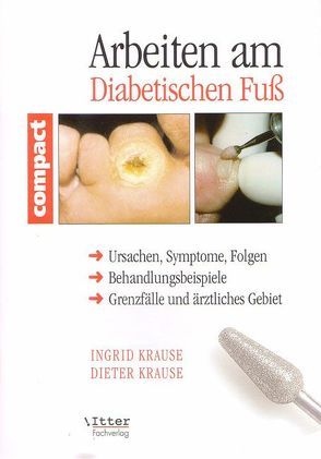 Arbeiten am Diabetischen Fuss von Itter,  Alexander, Krause,  Ingrid, Paul-Füssl,  Ingrid