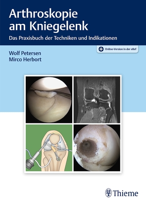 Arthroskopie am Kniegelenk von Herbort,  Mirco, Petersen,  Wolf