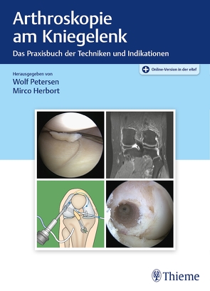 Arthroskopie am Kniegelenk von Herbort,  Mirco, Petersen,  Wolf