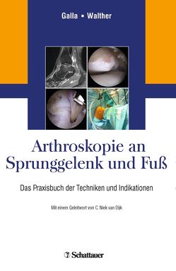 Arthroskopie an Sprunggelenk und Fuß von Galla,  Mellany, Walther,  Markus