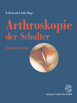 Arthroskopie der Schulter von Beck,  Emil, Resch,  Herbert
