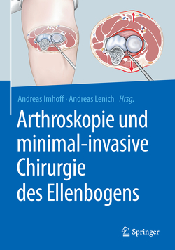 Arthroskopie und minimal-invasive Chirurgie des Ellenbogens von Imhoff,  Andreas B., Lenich,  Andreas