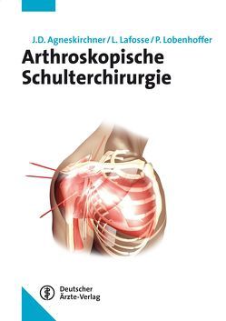 Arthroskopische Schulterchirurgie von Agneskirchner,  Jens D., Lafosse,  Laurent, Lobenhoffer,  Philipp