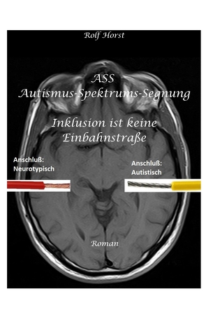 ASS Autismus-Spektrums-Segnung – Asperger-Syndrom, Sucht, Alkoholismus, Spiritualität, Buddhismus, Mobbing, Ausgrenzung, Missbrauch von Horst,  Rolf