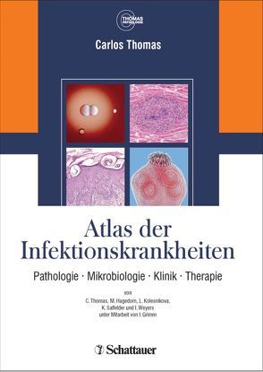 Atlas der Infektionskrankheiten von Cecetka-Thomas,  Annette, Thomas,  Carlos, Woicichowski,  Renate