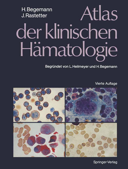 Atlas der klinischen Hämatologie von Begemann,  H., Begemann,  Herbert, Haferlach,  T., Heilmeyer,  L., Huhn,  Dieter, Kranz,  Bernd R., Mohr,  Werner, Rastetter,  Johann