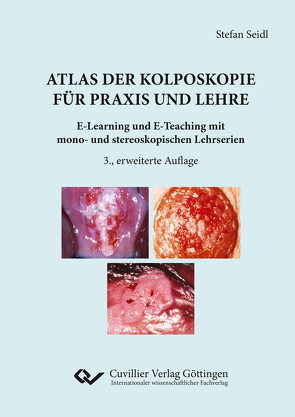 Atlas der Kolposkopie für Praxis und Lehre von Seidl,  Stefan
