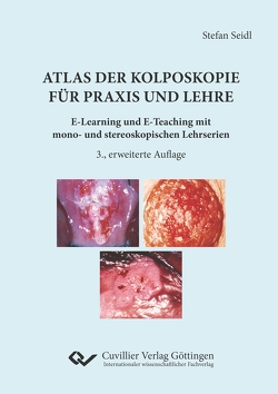 Atlas der Kolposkopie für Praxis und Lehre von Seidl,  Stefan