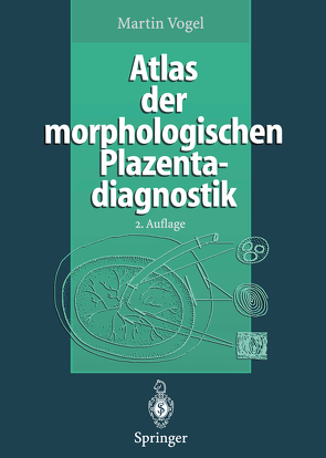 Atlas der morphologischen Plazentadiagnostik von Vogel,  Martin