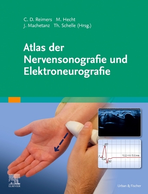 Atlas der Nervensonografie und Elektroneurografie von Hecht,  Martin, Machetanz,  Jochen, Reimers,  Carl Detlev, Schelle,  Thomas