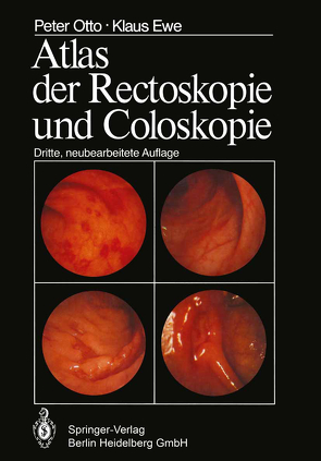 Atlas der Rectoskopie und Coloskopie von Ewe,  K., Otto,  P.