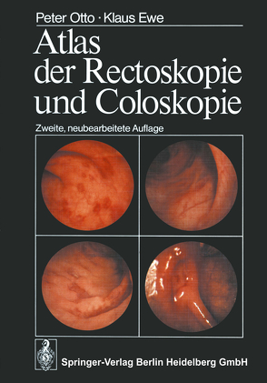 Atlas der Rectoskopie und Coloskopie von Ewe,  K., Otto,  P.