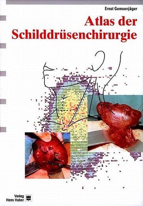 Atlas der Schilddrüsenchirurgie von Gemsenjäger,  Ernst