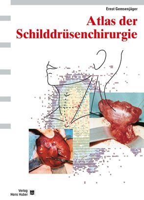 Atlas der Schilddrüsenchirurgie von Gemsenjäger,  Ernst
