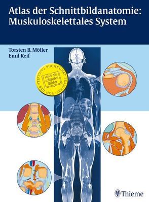 Atlas der Schnittbildanatomie: Muskuloskelettales System von Möller,  Torsten Bert, Reif,  Emil