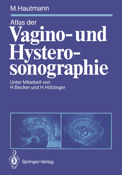 Atlas der Vagino- und Hysterosonographie von Becker,  Hermann, Hautmann,  Maximilian, Hötzinger,  Harald