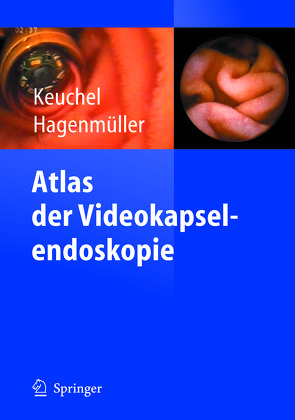 Atlas der Videokapselendoskopie von Hagenmüller,  Friedrich, Keuchel,  Martin