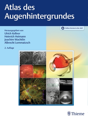 Atlas des Augenhintergrundes von Heimann,  Heinrich, Kellner,  Ulrich, Lommatzsch,  Albrecht Peter, Wachtlin,  Joachim