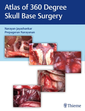 Atlas of 360 Degree Skull Base Surgery von Jayashankar,  Narayan, Narayanan,  Prepageran